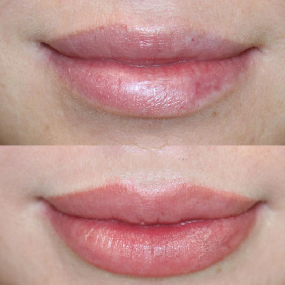 Precision Permanent Makeup Lips